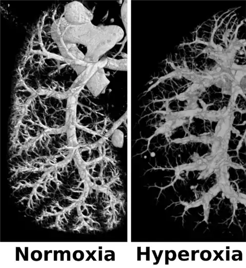Normoxia vs Hyperoxia